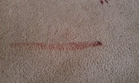 How to Remove Blood Stains from Your Carpet